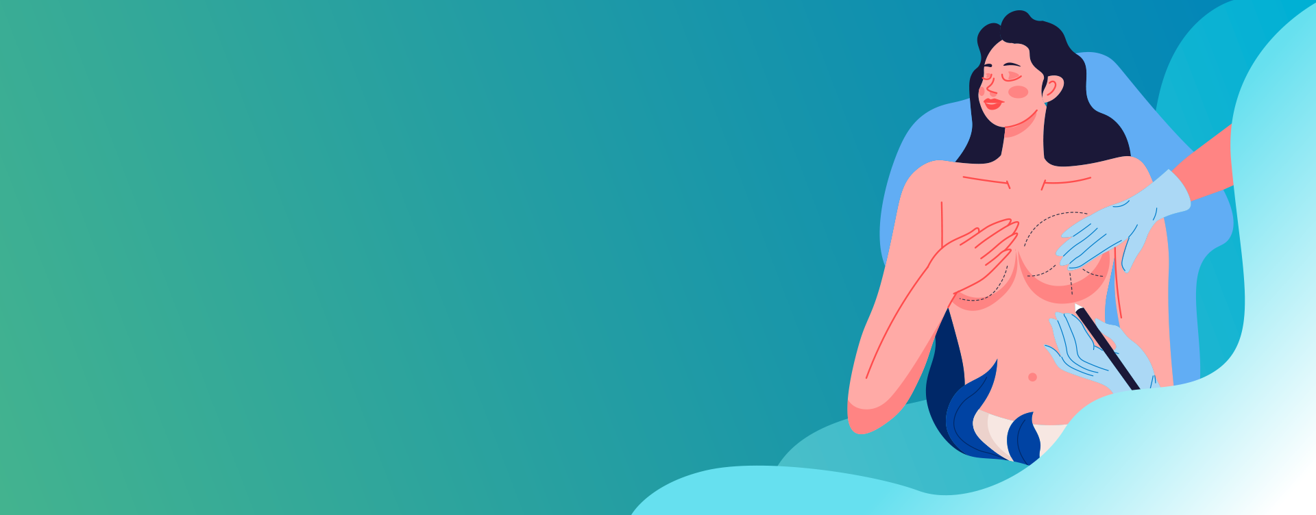 BREAST SURGERY