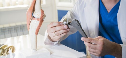 Protézisműtétek: felkészülés és rehabilitáció gyógytornásszal