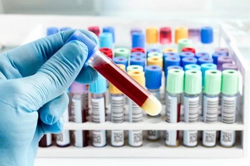 PHADIA molekuláris allergiavizsgálatok: a legszélesebb paletta