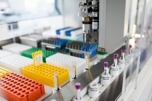 ANA ELISA Screen: poliszisztémás autoimmun betegségek vizsgálata