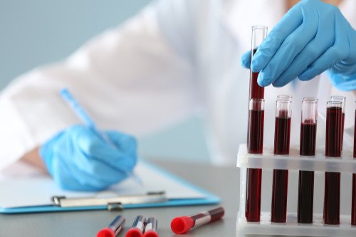 Általános egészségfelmérő laborcsomagok: melyiket válasszam?