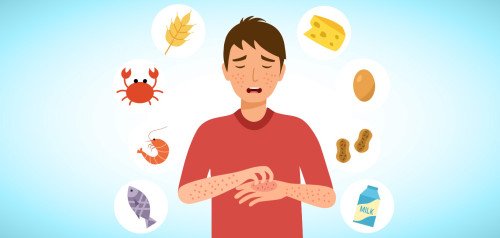 Allergia- és ételintolerancia vizsgálatok: mi a különbség?