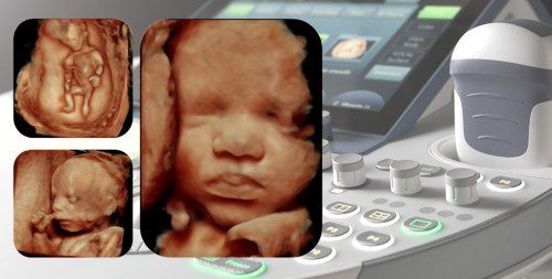 5D babamozi: így láthatjuk a picit még születése előtt