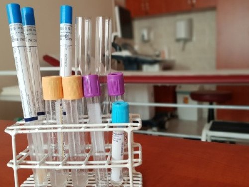 LABORDIAGNOSZTIKAI VIZSGÁLATOK A LEGJOBB HELYEN!