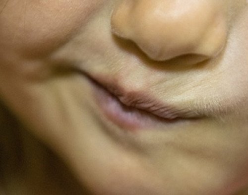 AZ ÍRÁST ÉS AZ OLVASÁST IS BEFOLYÁSOLHATJA AZ ELHANYAGOLT PÖSZESÉG