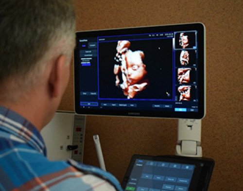 KAPOSVÁRON ELŐSZÖR: FELEDHETETLEN BABAMOZIZÁS 5D ULTRAHANGGAL