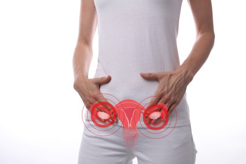 Rejtélyes női betegség: erre hívja fel a figyelmet az endometriózis hete